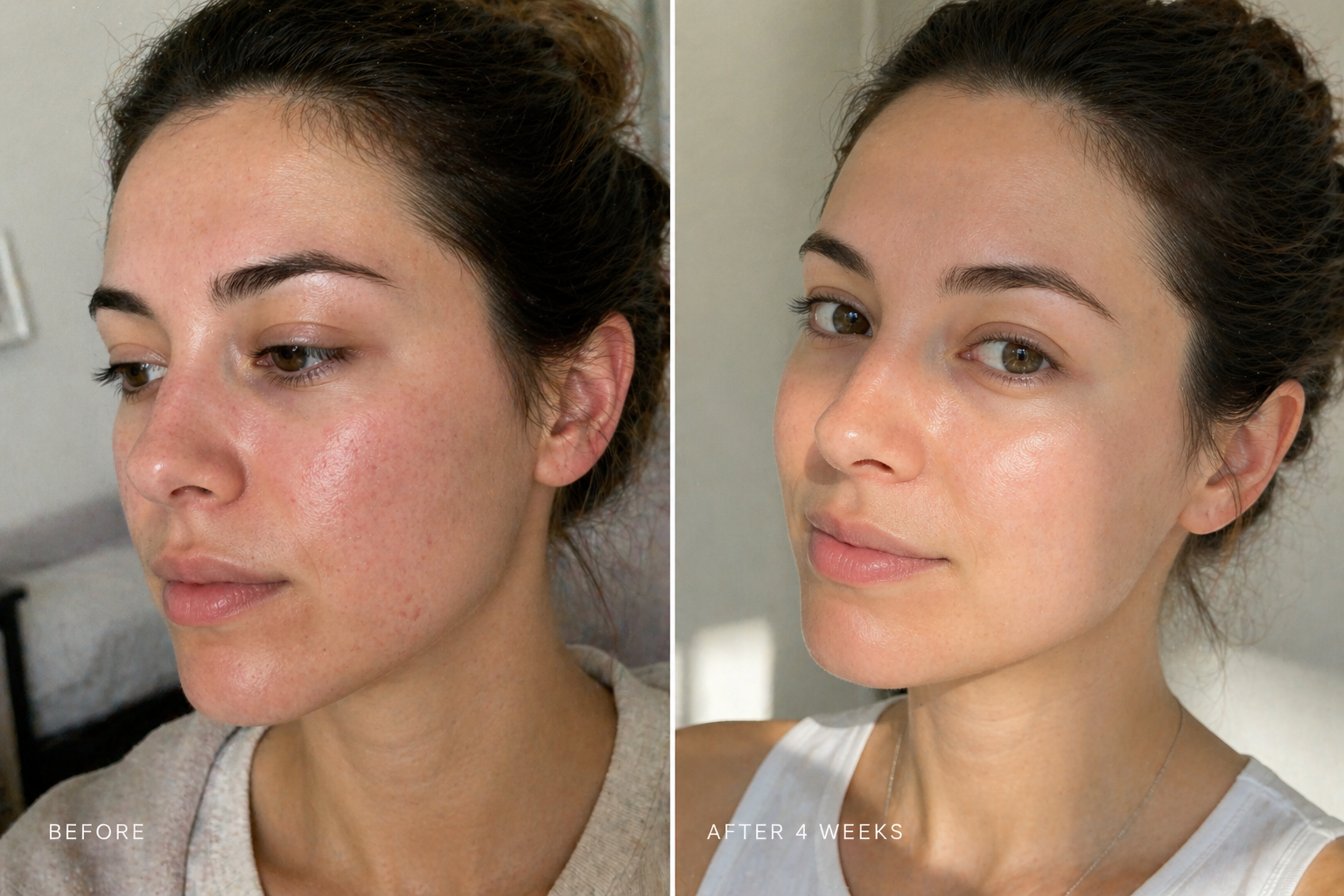Consistent skincare use comparison